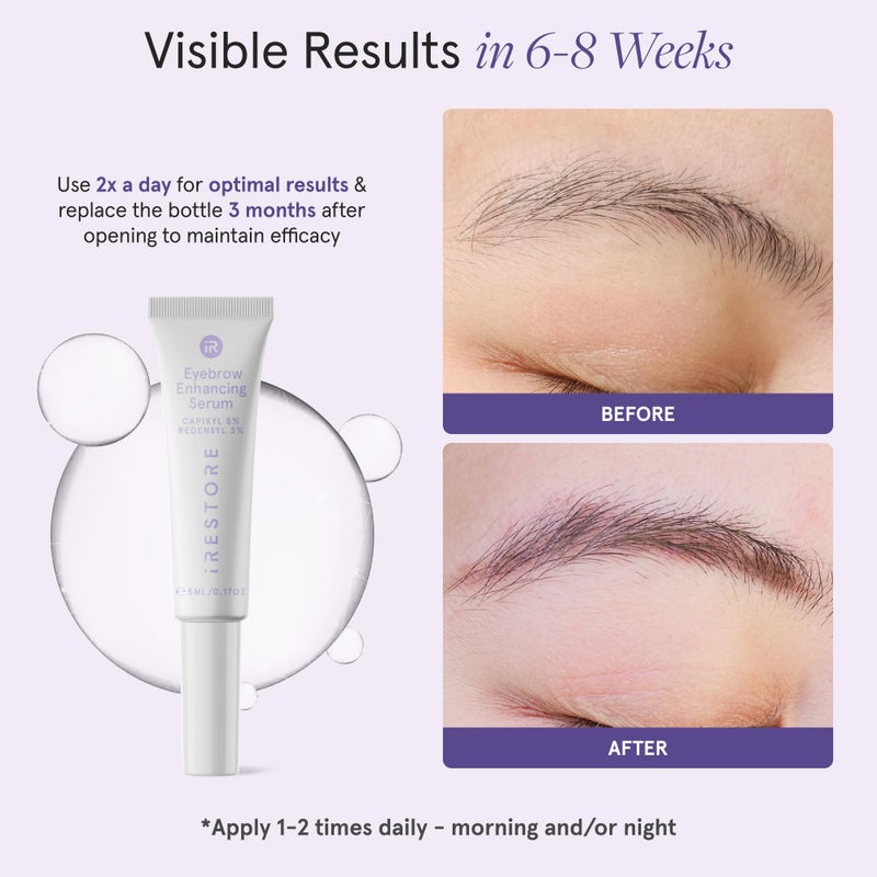 iRESTORE Eyebrow Growth Serum | Vegan Prostaglandin Free & Non Irritating | For Bolder Thicker Fuller Eye Brows with Visible Results | Brow Enhancing Serum | 3 Months Supply 5ml - Image 2