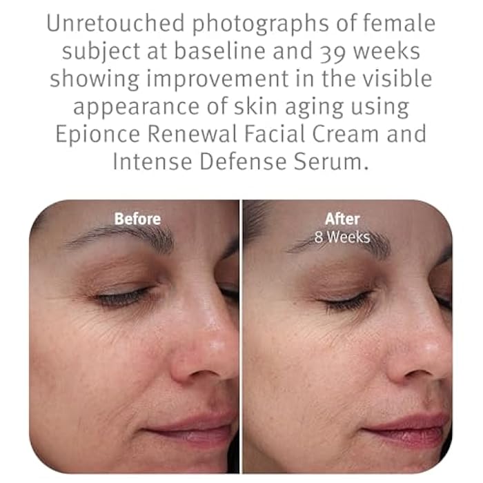 Epionce Renewal Facial Cream – Hydrating Anti-Aging Moisturizer | For Dry, Sensitive to Normal Skin | Fine Lines & Wrinkles | Dermatologist Skincare - Image 4