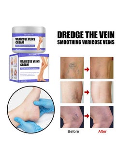 West&Month Varicose Veins Cream to Relieve Phlebitis Angiitis, Varicose and Spider Veins Massage Cream, Relieves Leg Swelling Pain and Fatigue, Improve Leg Appearance 30g  - Image 3