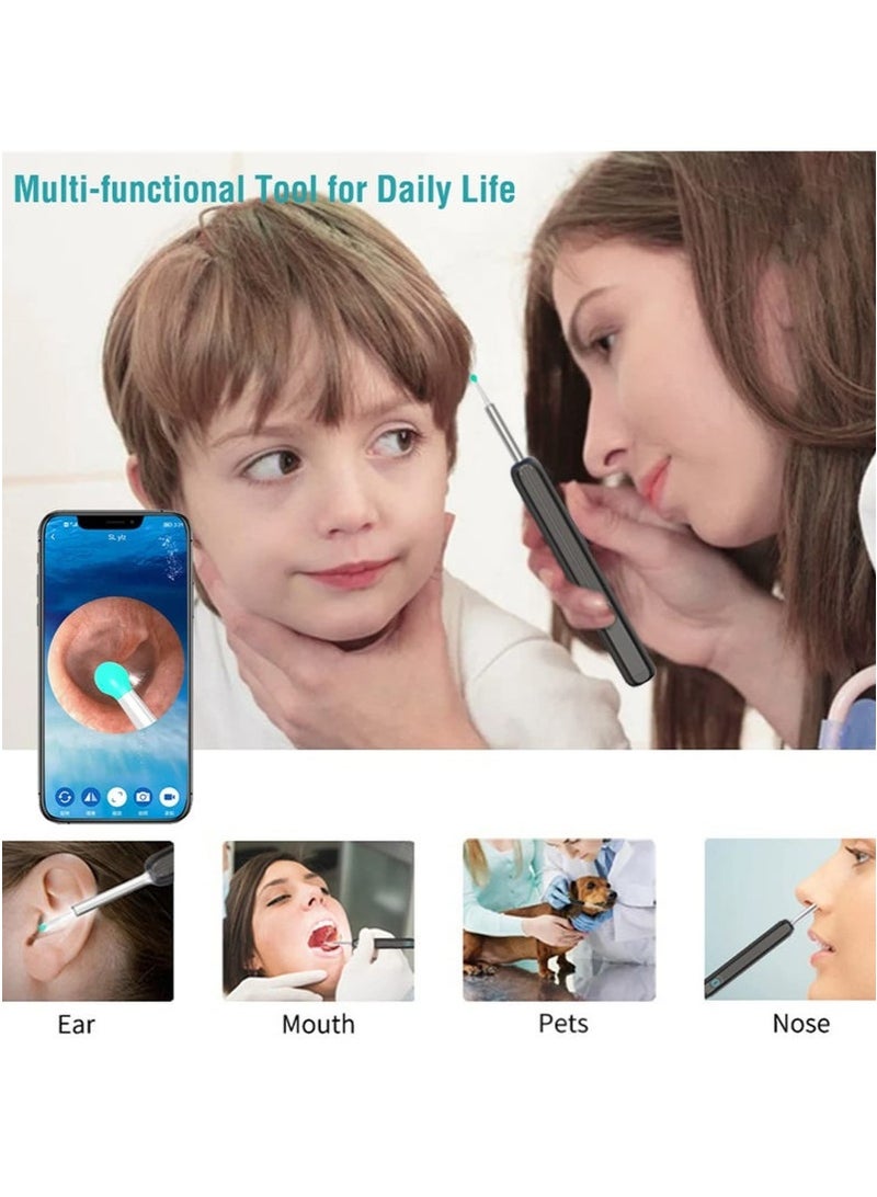 عام مجموعة إزالة شمع الأذن - مزيل شمع الأذن المرئي مع كاميرا، منظار الأذن مع ضوء، منظف الأذن مع 8 أدوات إزالة شمع الأذن + 6 مغارف أذن، مزيل شمع الأذن اللاسلكي لنظام iOS وهواتف Android، منظار الأذن المرئي عبر شبكة Wi-Fi لشمع الأذن (أسود) - Image 5