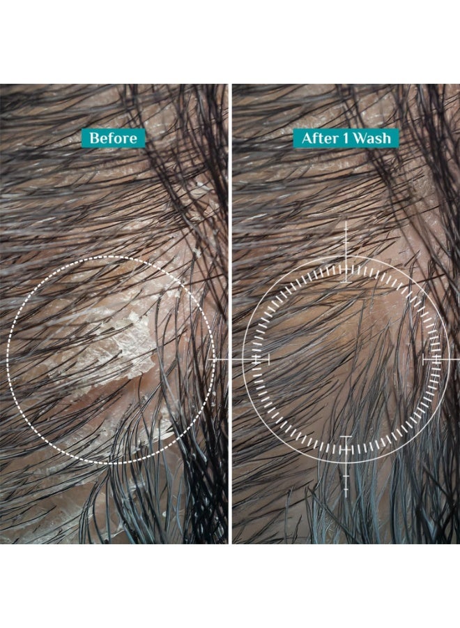 PILGRIM Australian Tea Tree Non Drying Anti Dandruff Shampoo 200 ml Removes Dandruff from Source  Helps with Itching Irritation Strong  Smooth Hair For Men and Women - Image 5