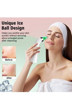 Excefore Blackhead Remover Vacuum, Electric Pore Blackhead Extractor, Facial Pore Cleaner-5 Suction Power, Pore Cleaner, USB Rechargeable Pimple Sucker, Vacuum Blackhead Remover Tools and 5 Probes  - Image 5