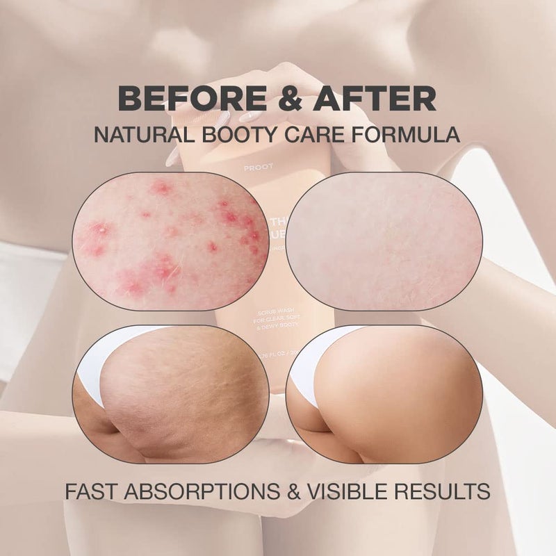 Proot Butt Scrub Wash | Booty Scrub Body Exfoliator for Acne, Ingrown Hair, Bikini & Razor Bump | Exfoliating Butt Scrub for All Skin Type | Butt Scrub Wash for Body Acne and Razor Bump | Butt Acne Scrub - Image 2
