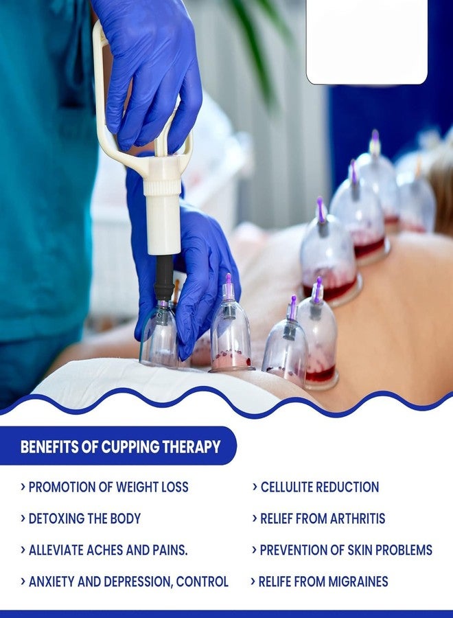 avyaan| Cupping Therapy Cups| Hijama Cupping Set| (Size 2, 24 Cups only) - Image 5