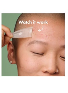 Mighty Patch Mighty Patch Hero Cosmetics Surface Patch - Hydrocolloid Spot Patch for Body, Cheek, Forehead, and Chin (10 Count)  - Image 4
