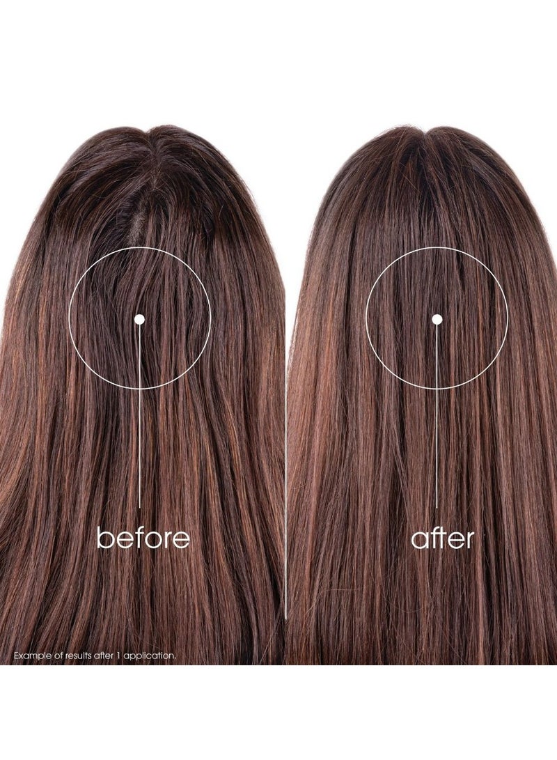 كلوران شامبو جاف بخلاصة نبات القراص من كلوران للشعر الدهني بني 150 مل - Image 3