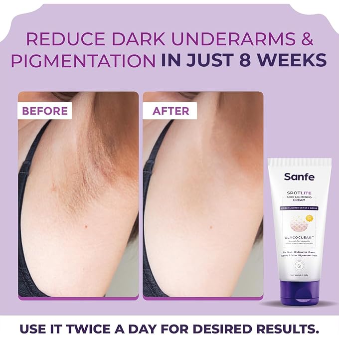 Sanfe Spotlite Body Cream For Dark Neck, Joints and Skinfolds | Enriched with 3% Lactic Acid, Retinol & SPF 15 | For Dark Patches, Detanning, Anti Aging and Skin Tightening 60gm - Image 3