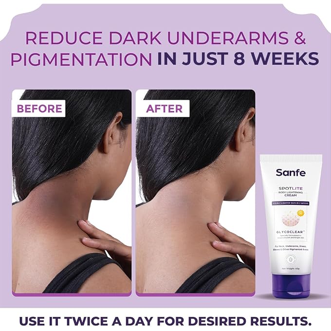 Sanfe Spotlite Body Cream For Dark Neck, Joints and Skinfolds | Enriched with 3% Lactic Acid, Retinol & SPF 15 | For Dark Patches, Detanning, Anti Aging and Skin Tightening 60gm - Image 2