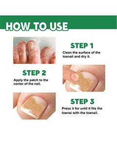 BUPY Bupy Nail Repair Patch For Hands And Feet, Soft Ingrown Nails, Thickened Nails, Bright Nails, Nail Grooves, Onychomycosis Care Patch  - Image 4