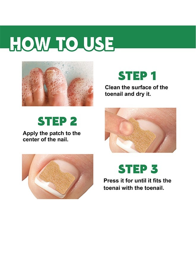 BUPY Bupy Nail Repair Patch For Hands And Feet, Soft Ingrown Nails, Thickened Nails, Bright Nails, Nail Grooves, Onychomycosis Care Patch  - Image 4