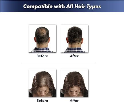 KeraFiber Hair Building Fibres Natural Keratin Hair thickener Fibres Hair Powder for Men and Women Full Head of Hair in 30 SecondsHair Fibres Light Brown - Image 2