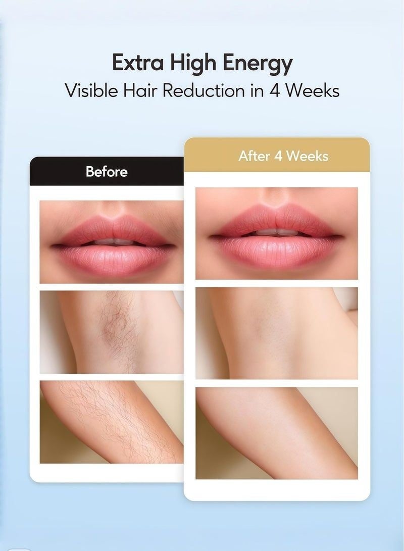 3-In-1 Home Laser Hair Removal Device, 9 Adjustable Energy Levels, 999,999 Flashes, IPL Technology and Cooling Function, Painless Permanent Hair Remover，Painless Hair Removal, Skin Rejuvenation, Remove Spots pink - Image 4