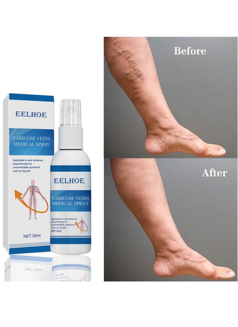 Varicose Veins Medical Cream, Eliminate Spider Veins Spray, Relieve Varicose Veins, Improve Blood Circulation, Relieve Leg Fatigue, Anti-Edema, Improve Blood Circulation and Quickly Reduce Swelling