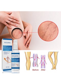 EELHOE Varicose Veins Medical Cream, Eliminate Spider Veins Spray, Relieve Varicose Veins, Improve Blood Circulation, Relieve Leg Fatigue, Anti-Edema, Improve Blood Circulation and Quickly Reduce Swelling  - Image 4