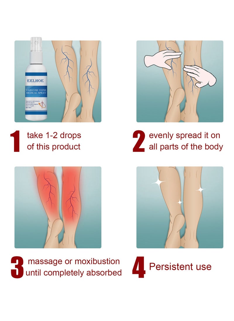 Varicose Veins Medical Cream, Eliminate Spider Veins Spray, Relieve Varicose Veins, Improve Blood Circulation, Relieve Leg Fatigue, Anti-Edema, Improve Blood Circulation and Quickly Reduce Swelling