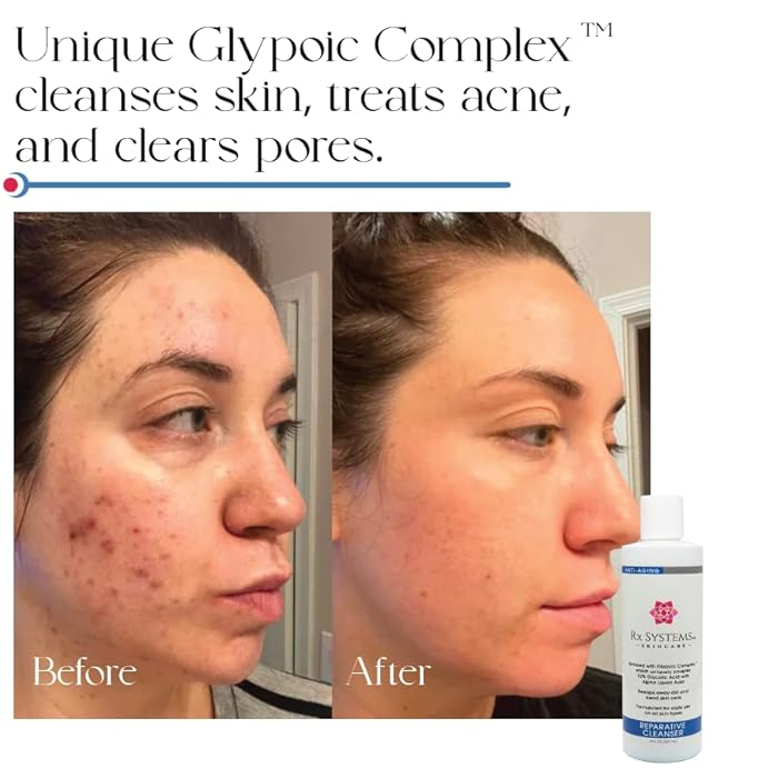 Rx Systems PF Reparative Facial Cleanser 8 oz, Repairs Skin, Clears away Oil and Dirt Build Up, Prevents Acne and Clogged Pores - Image 3