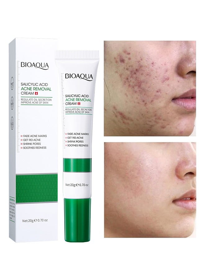 BIOAQUA Salicyuc Acid Acne Removal Cream, Acne Treatment Face Cream, Acne Spot Treatment for Face & Acne Dots, Natural Cystic Acne Treatment, For All Skin Types, Premium Acne Scar Cream & Pimple Remover 20g - Image 1