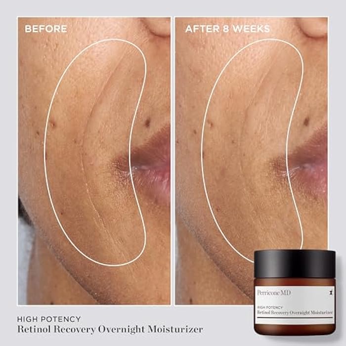 Perricone MD High Potency Classics Retinol Recovery Overnight Moisturizer - Image 3