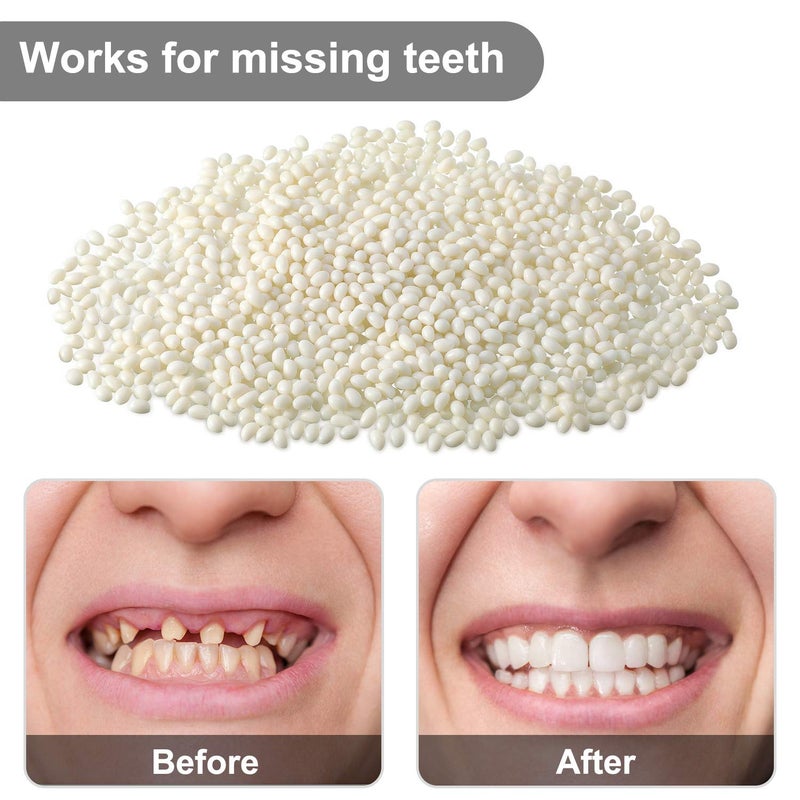 Nuanchu 100g Bead Teeth Tooth Solid Gel Replacement Moldable Thermal Fitting Bead Teeth Pellet Fake Teeth Filler for Missing Broken Tooth Halloween Scary Themed Party Makeup - Image 2