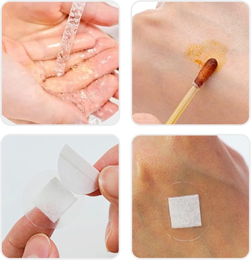 AndicAge 100pcs Adhesive Spot Bandage 1 Inch Clear Round Adhesive Bandages with NonStick Pad for Hands Arms Small Wounds 1 Box - Image 5