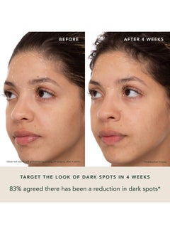 RANAVAT BOTANICS RANAVAT Brightening Saffron Face Serum - Discoloration Correcting Serum & Vitamin C Serum Alternative - Improves Appearance of Hyperpigmentation & Dark Spots (0.17 oz)  - Image 4