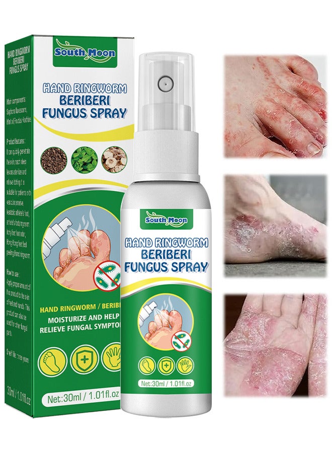 SOUTH MOON Hand Ringworm BeriBeri Fungus Spray, Anti-Fungi Treatment For Feet Itchy, Sweating, Peeling And Blisters, Natural Ingredients Foot Fungi Spray For Tinea Pedis, Inflamed, Feet Smelly 30ML - Image 1