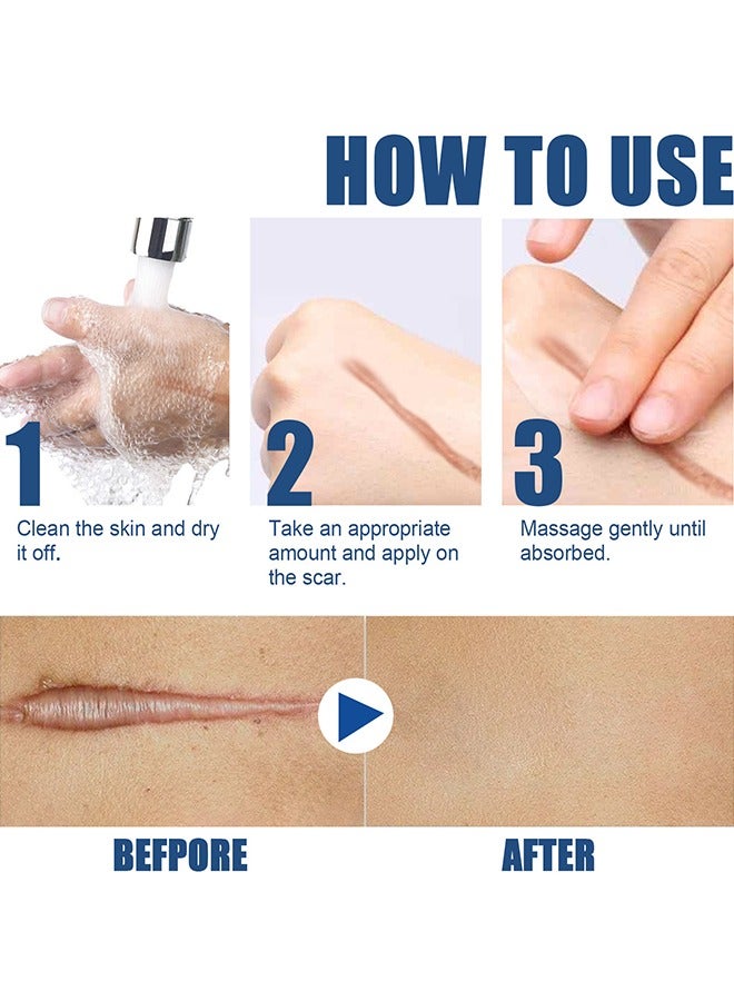 EELHOE Skin Repair Balm, Scar Cream Care Burn Mark Acne Mark Fading Smoothing Care Cream Scar Cream - Image 4