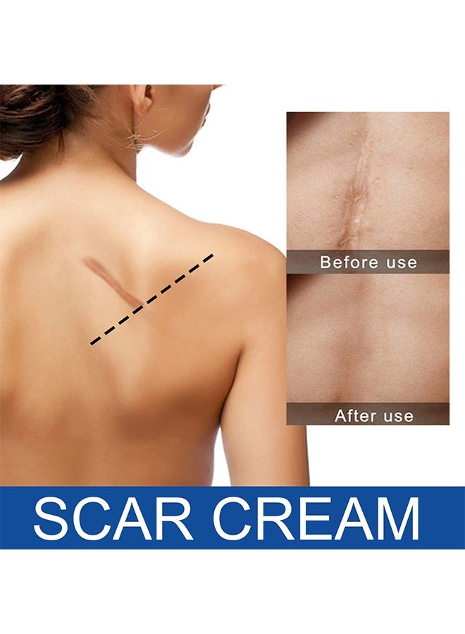 EELHOE Skin Repair Balm, Scar Cream Care Burn Mark Acne Mark Fading Smoothing Care Cream Scar Cream - Image 2