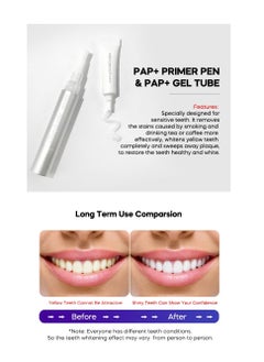 GlorySmile 6 Treatments Pap+ Formula Teeth Whitening Kit for Dentist-Level Tooth Whitening Effect Sensitive-Free Enamel Safe Professional Teeth Whitening Kit  - Image 4