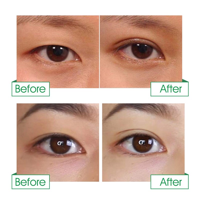 Pormasbenzer 656PCS/328Pairs Natural Invisible Large One-sided Sticky Double Eyelid Strips Eyelid Tape Stickers, Eye Without Surgery, Perfect for Single, Hooded, Droopy, Uneven, or Mono-eyelids - Image 3