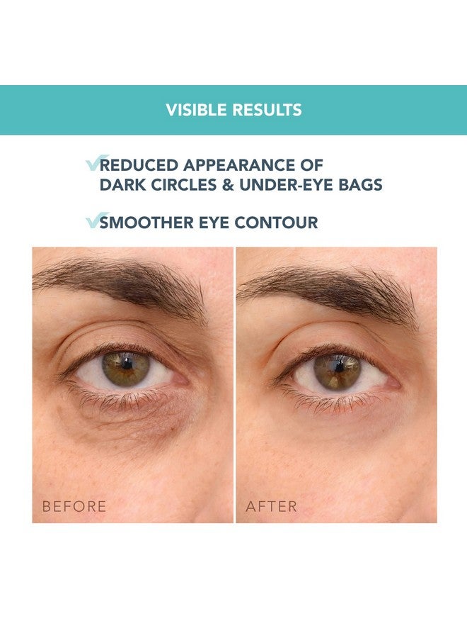 FOREO Iris C-Concentrated Brightening Eye Cream For Dark Circles And Puffiness - Under Eye Brightener - Hyaluronic Acid - Antioxidant - Vegan - Travel Size - All Skin Types - 0.5 Oz - Image 3