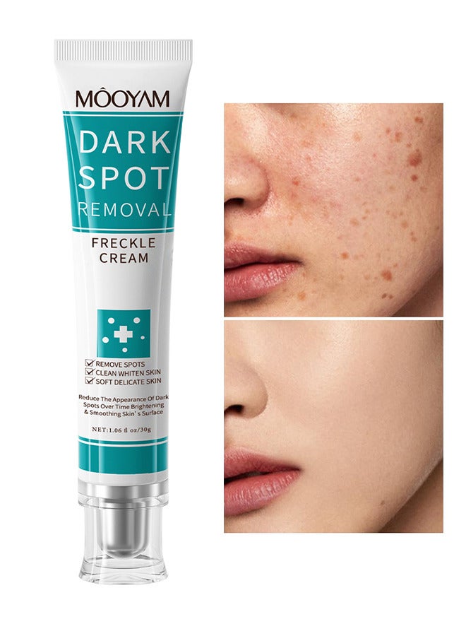 MOOYAM Dark Spot Removal Freckles Cream, Reduce Freckles And Improve Skin Tone, For Face Peeling Skin Whitening Freckle Cream Pigmentation Treatment Sun Spots Age Spots Blemish Remover Lightening Cream - Image 1