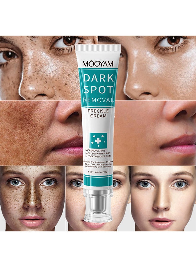 MOOYAM Dark Spot Removal Freckles Cream, Reduce Freckles And Improve Skin Tone, For Face Peeling Skin Whitening Freckle Cream Pigmentation Treatment Sun Spots Age Spots Blemish Remover Lightening Cream - Image 2
