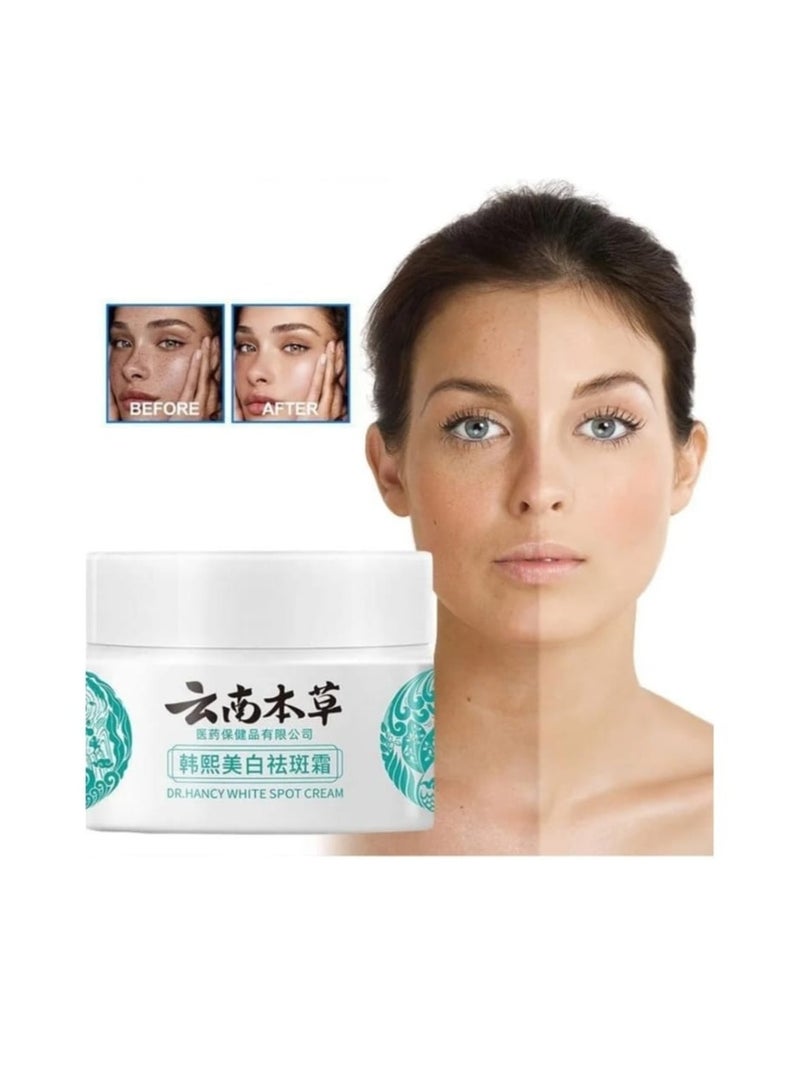 Karim Japanese Melasma Cream Dr. Hansi White Spot Cream China, Dr. Hansi White Spot Correction Cream, Chinese Dark Spot Correction Cream Dr. Hansi Prevent White Spots for Dry and Sensitive Skin by Hansi-3pcs - Image 2