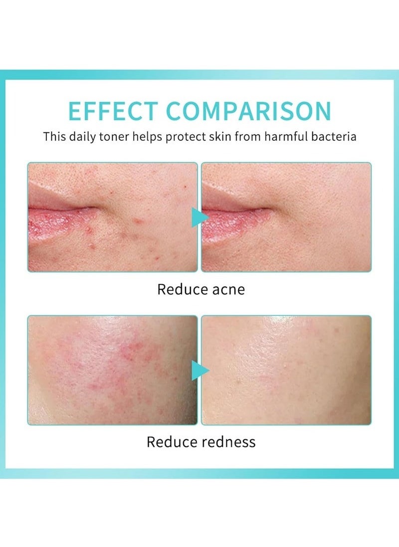 lakerain Hypochlorous Acid Spray for face, Daily Rescue Facial Spray, Toner Soothing and Purify, Facial Mist, Support Against Irritation, Calm Redness  - Image 4