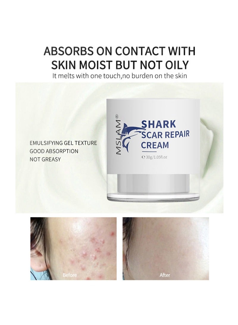 MSLAM Scar Removal Cream， Facial And Body Scar Repair，Lightening Scars And Acne Marks， Using Natural Ingredients (30g) - Image 3