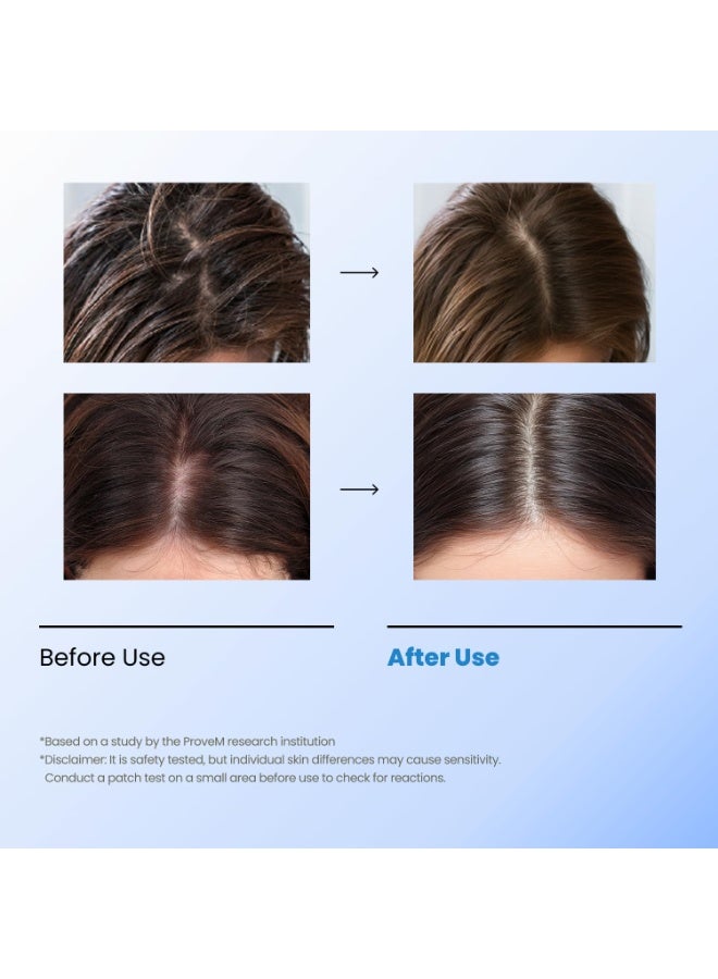 Seapuri تونك الفقاعات | مقشر فروة الرأس بدون شطف للرؤوس الدهنية، المتعرقة، أو الحاكة | يزيل التراكمات والعرق بدون بقايا | راحة تبريد مع المنثول وحمض الساليسيليك | ديتوكس العناية بالشعر الكوري - Image 5