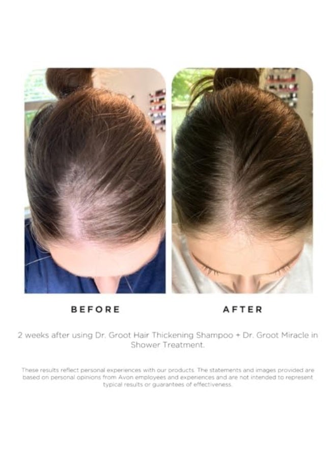 Dr.Groot Dr. Groot Hair Thickening Shampoo, Korean Hair Care with Biotin, Rosemary Oil to Help Volumize Thinning, Damaged Hair, Hydrate Hair and Scalp, Biotin Shampoo, Scalp Revitalizing Solution - Image 4