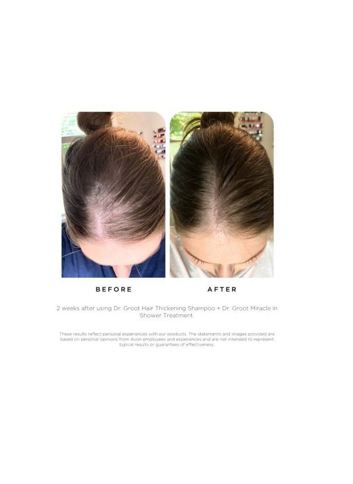 Dr.Groot - Dr. Groot Hair Thickening Shampoo, Korean Hair Care with Biotin, Rosemary Oil to help Volumize Thinning, Damaged Hair, Hydrate Hair and Scalp, Biotin Shampoo,Scalp Revitalizing Solution - Image 1