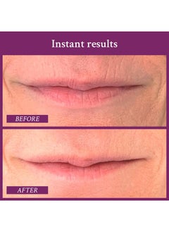 PRAI PRAI Beauty Ageless Lip and Line Filler for Instantly Ageless Lips | Lip Serum that Plumps, Smooths, & Fills In Lines | Moisturizing Lip and Line Filler with Vitamins C & E to Boost Collagen  - Image 5