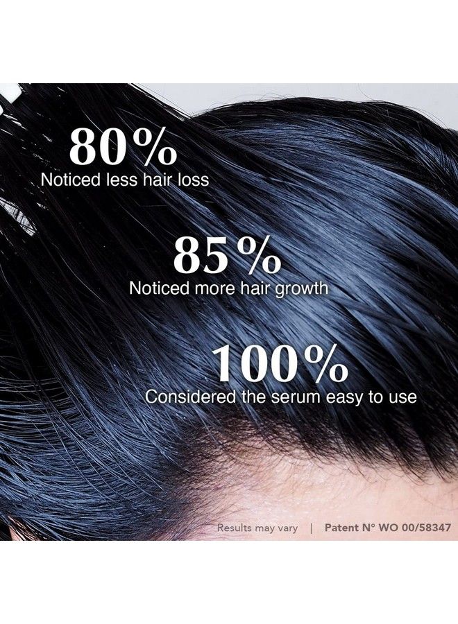 HAIRTAMIN Scalp Serum Natural Hair Growth Thickening Treatment Moisturizes And Soothes Dry Itchy Scalp - Image 5