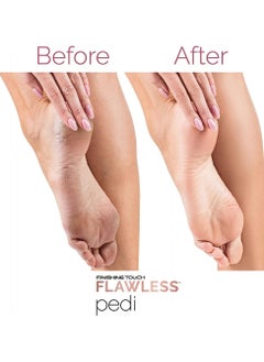 Pedi Rechargeable foot peeler with extra head  - Image 4