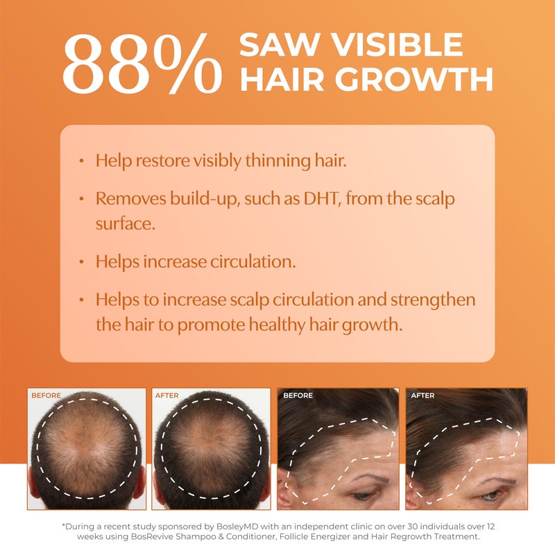 BosleyMD BosRevive Color-Safe Hair Care Kit for Thinning Hair, Starter Size (30 Days) â€“ Shampoo, Conditioner & Thickening Treatment with Biotin, Panthenol & Botanical Extracts - Image 3