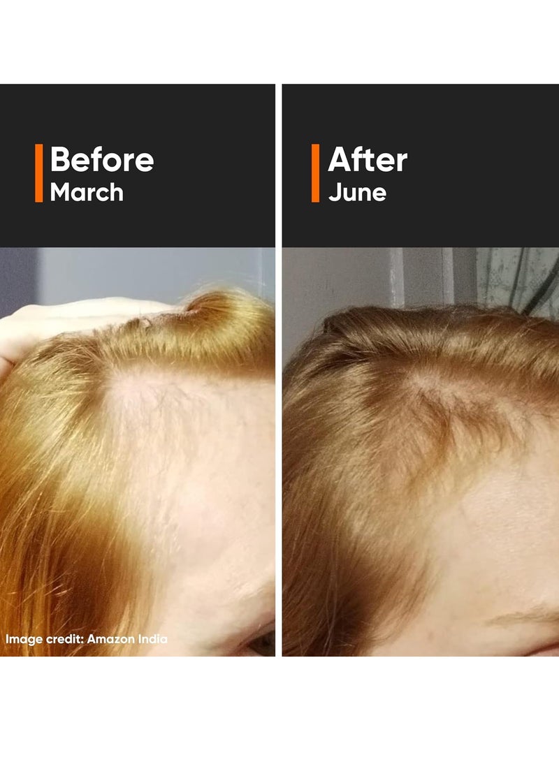 Minimalist Hair Density Serum for Hair Fall & Hair Loss Control | Strenghtens Hair Follicle for New Hair Cycle | With Procapil, Capixyl, Redensyl, Anagain & Baicapil | For Men & Women | 1 fl oz - Image 4