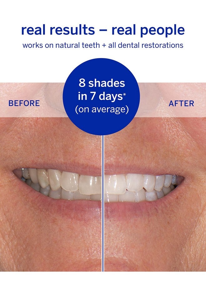 Supersmile Dissolving Superstrips By Supersmile Professional Teeth Whitening Strips Enamel Safe Teeth Whitener For Sensitive Teeth… - Image 3