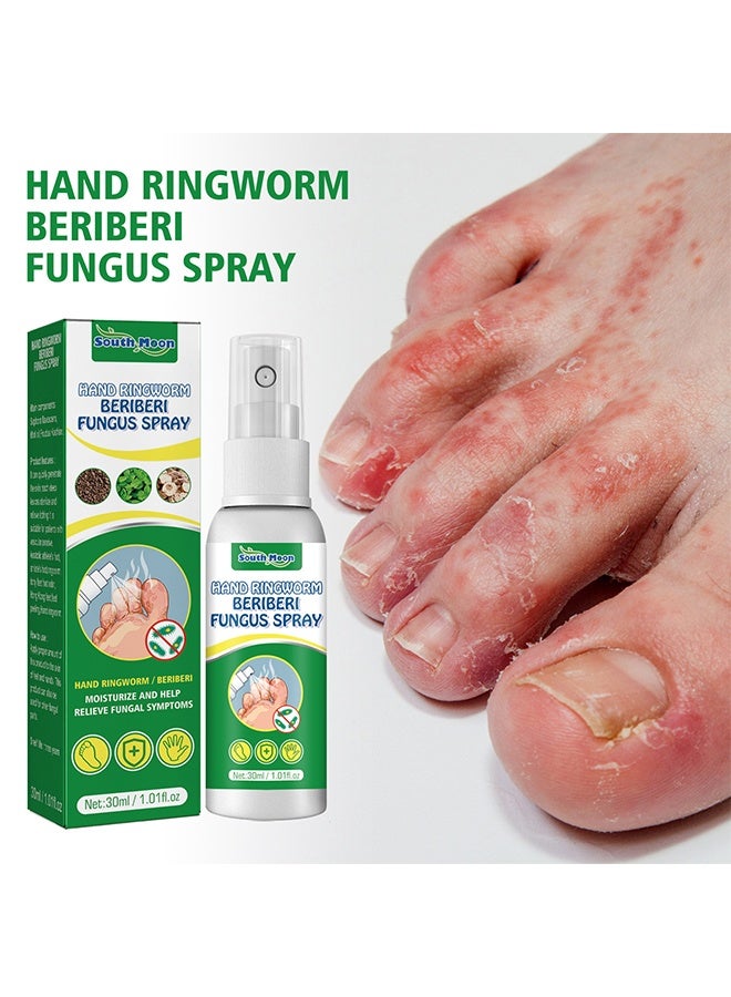 SOUTH MOON Hand Ringworm BeriBeri Fungus Spray, Anti-Fungi Treatment For Feet Itchy, Sweating, Peeling And Blisters, Natural Ingredients Foot Fungi Spray For Tinea Pedis, Inflamed, Feet Smelly 30ML - Image 1