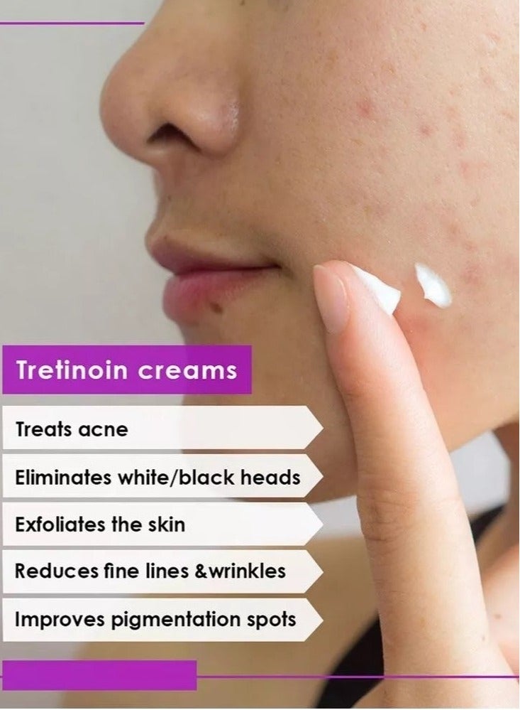 جمجوم فارما مجموعة من 4 عبوات كريم العناية بالبشرة أكريتين 0.05% علاج متكامل والحل الأمثل والنهائي لحب الشباب ومشاكل الجلد والبشرة 30 جم - Image 4