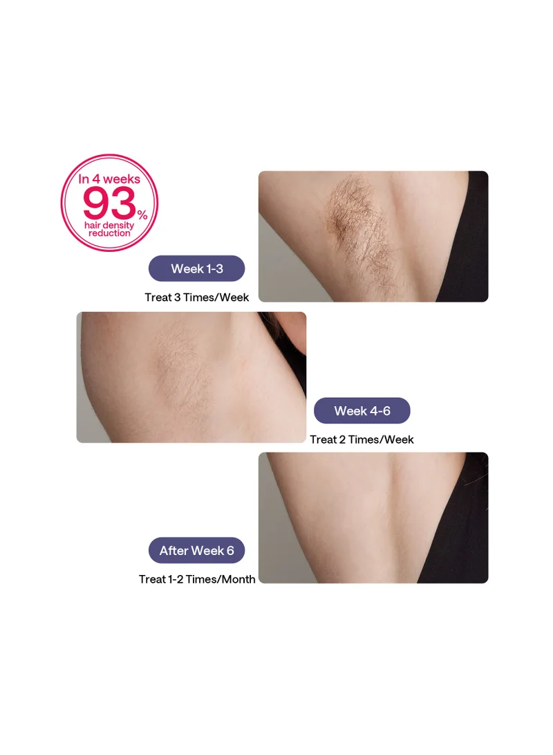Ulike Laser Hair Removal For Women And Men, Air 3 Ice-Cooling Ipl Device Hair Removal For Nearly Painless And Long-Lasting Results Purple