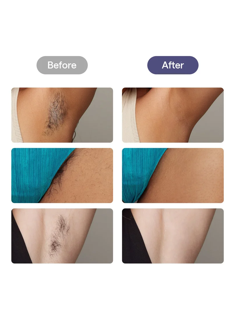 Ulike Laser Hair Removal For Women And Men, Air 3 Ice-Cooling Ipl Device Hair Removal For Nearly Painless And Long-Lasting Results Purple