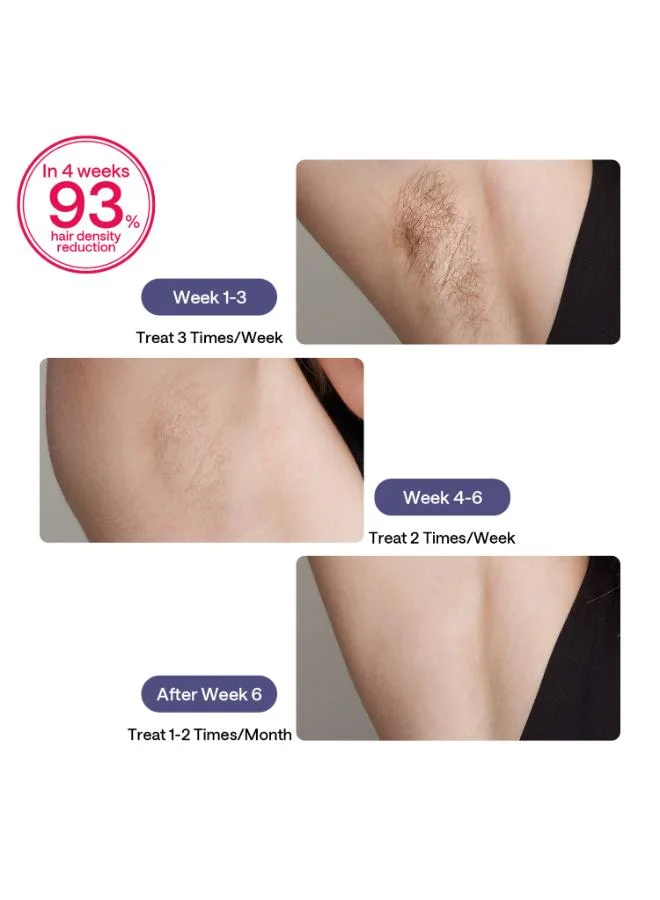Ulike Laser Hair Removal For Women And Men, Air 3 Ice-Cooling Ipl Device Hair Removal For Nearly Painless And Long-Lasting Results Purple